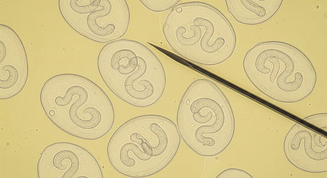 Microscopic View of Parasitic Hookworm Eggs with Developing Larvae
An authentic, high-magnification micrograph captured under a laboratory microscope, displaying multiple oval-shaped eggs 
