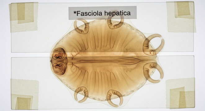 Liver Fluke Specimen, Fasciola hepatica, Mounted on Glass Slide
A high-magnification, scientific photograph of a stained and permanently mounted specimen of Fasciola hepatica