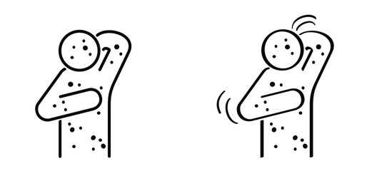 Skin rash, measles on face. Red rash on the body. A sign of measles, lupus, herpes, or rubella, and other autoimmune diseases. Rubeola or morbilli symptom. food allergy. Red spots on body. Itchy skin.