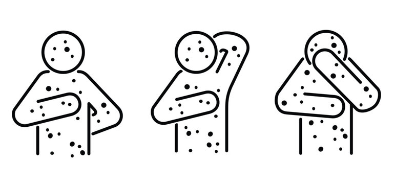 Skin rash, measles on face. Red rash on the body. A sign of measles, lupus, herpes, or rubella, and other autoimmune diseases. Rubeola or morbilli symptom. food allergy. Red spots on body. Itchy skin.