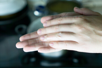 two hands clasped together with a bandaged finger after a stove burn, blurred kitchen background with cooking utensils, concept of first aid, kitchen safety, minor injury