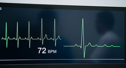 Closeup of a heart rate monitor displaying a 72 bpm reading