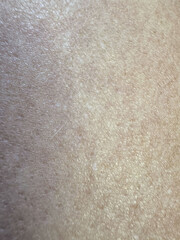 Close-up of human skin texture showing fine details and natural variation in shade and tone