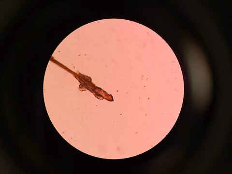 Demodex Mite Viewed Under a Microscope 