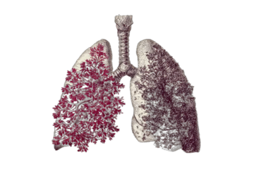 Medical illustration depicting lungs with a tree-like texture and artistic contrast on black
