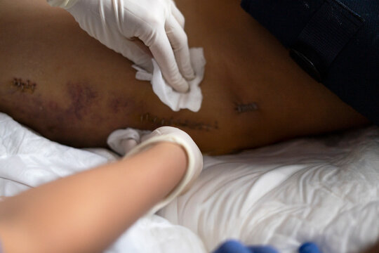 Nurse student caring for patient in ICU setting