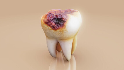 Conceptual 3D illustration of a decayed tooth