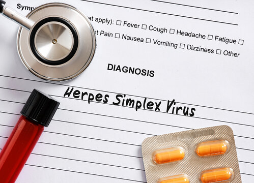 Doctor diagnosing herpes simplex virus with stethoscope, medication and blood sample