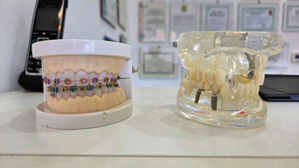 Colorful orthodontic braces on dental models for educational display. Horizontal banner. Copy space. Close-up
