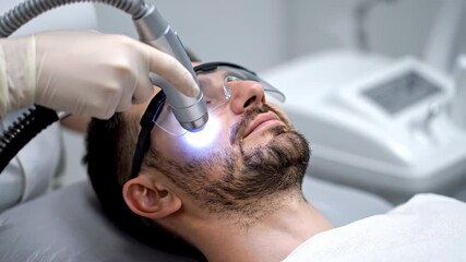 Cosmetologist administering laser facial resurfacing therapy on a male client's cheek at a state of the art beauty clinic. Modern equipment being used for cosmetology treatment