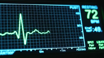 closeup of medical monitor showing green electrocardiogram line. screen displays patient's vital signs and resting heart rate of 72 bpm. healthcare technology concept. - Powered by Adobe
