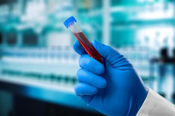 Doctor hold test blood sample in tube
