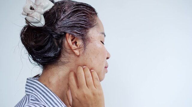 Asian woman reacting to hair dye allergy, feeling itchy and scratching her face, neck, and scalp.  rash, redness, and skin irritation caused by chemical reaction. allergic symptoms, scalp burning, 