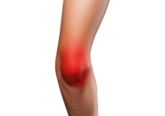 Inflamed elbow (Turns slightly red). isolated on transparent or white background