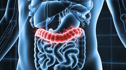 Close-up 3D holographic scan of the human torso and internal organs, in a blue X-ray style. The large intestine (colon) is highlighted and glows red, visualizing inflammation or digestive pain. - Powered by Adobe