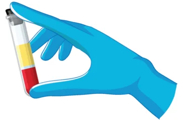 Fototapete Rund Kinder Gloved Hand Holding Blood Sample Test Tube  © GraphicsRF