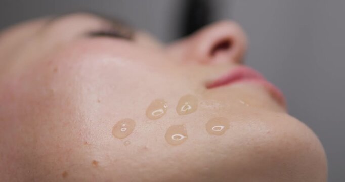 Woman receives cosmetic facial treatments. Microneedling for facial skin. Restoration and rejuvenation of female beauty and health. Beauty business.