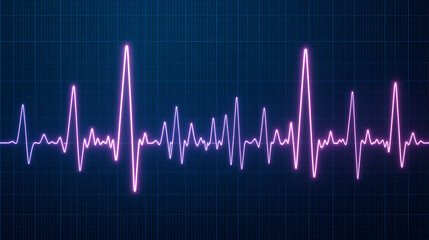 Electrocardiogram with cardiac arrhythmia. Atrial fibrillation recorded as the origin of many cerebrovascular accidents or strokes.