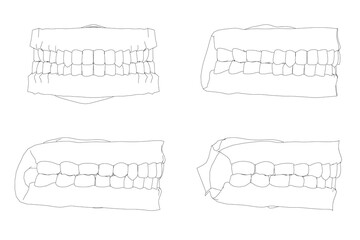 Four human teeth contours in varied shapes and sizes, featuring curved and straight designs