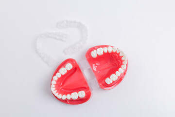 Top view Orthodontic model with clear aligners on white background