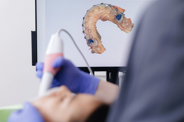 Dental 3d scan imaging process with patient with braces and technician in clinic setting