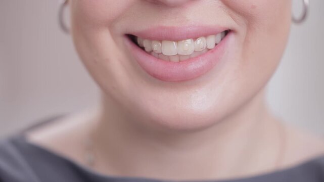 Close-up of caucasian female showing dental invisalign aligner on teeth, white light background.