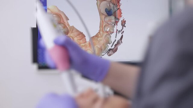 Dentist scanning patient's teeth with braces intraoral 3D scanner in modern clinic.