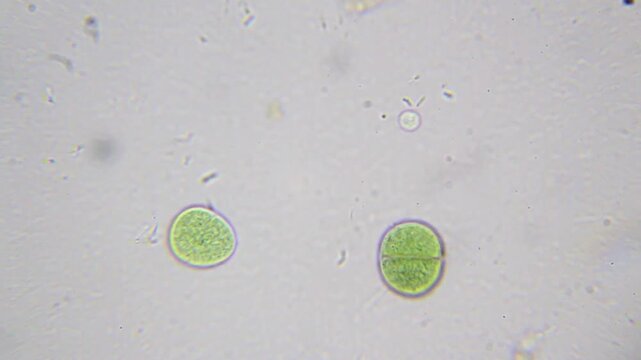 Two cyanobacteria, a tiny flagellated microbe &ldquo;bouncing,&rdquo; and spiral-shaped bacteria at 2000x (brightfield, oil immersion)