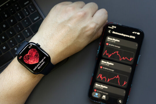 Apple Watch ECG Monitoring on Wrist for Heart Health Tracking. digital health tools, preventive care, heart disease awareness, and monitoring through smart wearable.