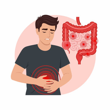 Man suffering from abdominal pain and inflamed colon illustration. Digestive system diseases, IBD, and IBS symptoms concept.