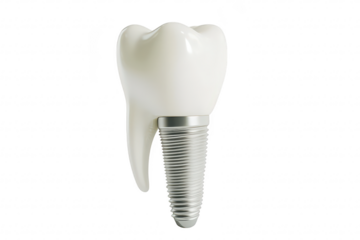 A close-up view of a realistic dental implant a white tooth crown attached to a metallic screw. symbolizing advanced dental technology in a clean. minimalistic setting