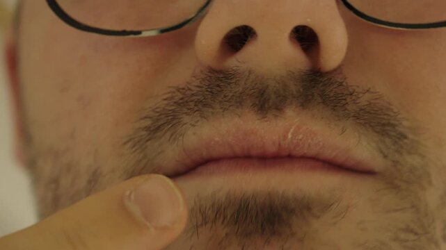 Close-up of a man touching his dry, chapped lips with his finger &mdash; concept of winter dryness, skincare, dehydration, and lip care.