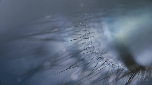 A part of housefly hairy body under microscope