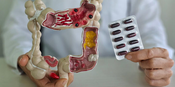 Treatment and prevention of constipation and diarrhea