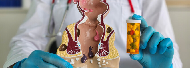 Doctor proctologist holding blisters with pills and anatomical model of rectum concept
