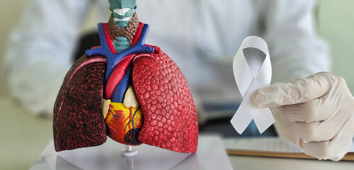 November Lung Cancer Awareness month. Doctor with Smoker Lung anatomy model and White ribbon in hospital concept
