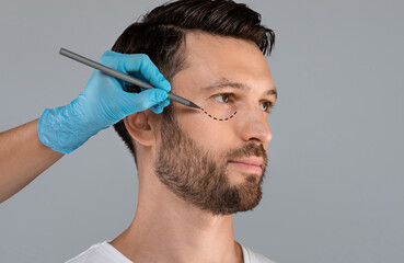 Handsome man with pencil marks under eyes for cosmetic surgery or correction, ready for operation. Plastic Surgery concept. Plastic surgeon applying marks on man face before surgery, grey background