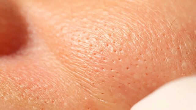 A close-up view of textured skin showing pores and fine hairs. The skin is a reddish-pink hue, with uneven surface details