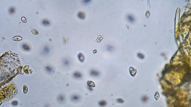 Micro organisms Ciliates moving in water