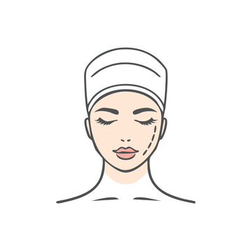 Cosmetic Surgery Face Lift Preparation with Marked Lines Illustration