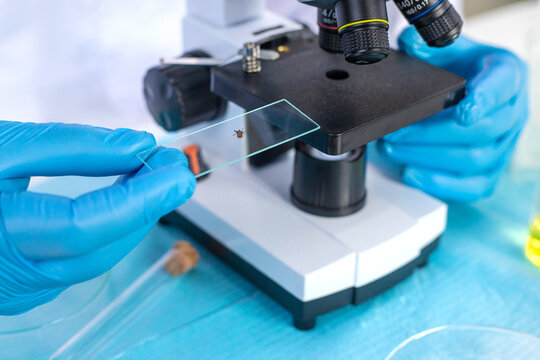 Examine a tick in a lab. Selective focus.