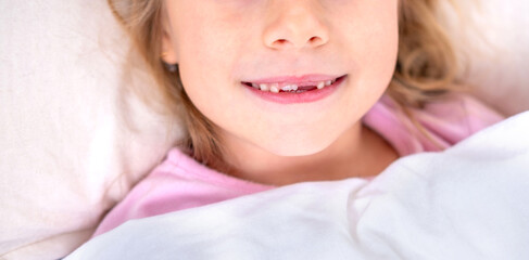Close-up cheerful young girl smiling widely in bed, showing gap from missing front baby tooth, symbolizing growth, dental transition, and morning happiness, carefree childhood
