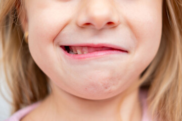 woman making playful, puckered-lip face, funny selfie expression, moment lighthearted humor and youthful pure, unadulterated fun, humor, self-expression, facial expression, amusement and warmth