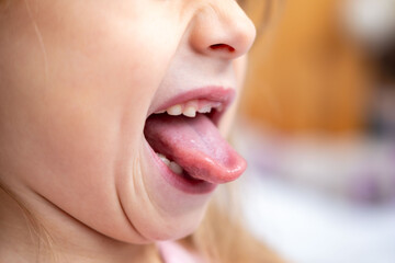 Child showing tongue, Young girl sticking out tongue, playful expression, tongue visible, speech therapy, pronunciation practice session, practicing sounds, oral anatomy health, dental tongue exercise