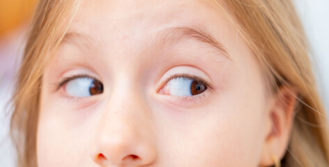 curious little girl looking sideways, child glancing with mischievous spark, ophthalmological examination, playful mood, innocent childhood, suspicious or perplexed, mischief or playful trickery