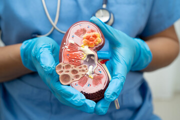 Chronic kidney disease, doctor with model for treatment urinary system, urology, Estimated glomerular filtration rate eGFR.