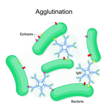 Bacterial agglutination. Medical test for pathogen detection. Bacteria Cells clumping. IgM Antibody antigen interaction. Epitopes
