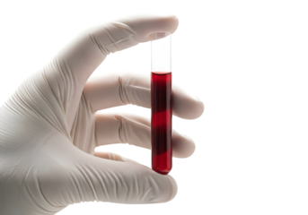 hand holding test tube with blood on transparent background 