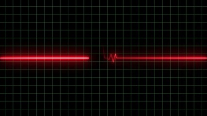 Vital signs on medical monitors, looping 4K of neon red electrocardiogram (ECG) graph lines on black background. Medical concept showing heart rate. - Powered by Adobe