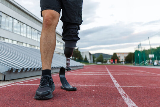 Man running on an athletic track, wearing a prosthetic foot, an orthopedic mobility aid for amputees at sports activities.